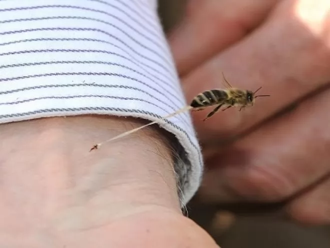 صور - صورة نآدرة تفسر سبب موت النحلة عند لدغها للإنسان