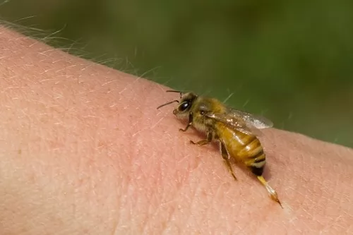 صور - لماذا لدغة النحل مؤلمة للغاية ؟