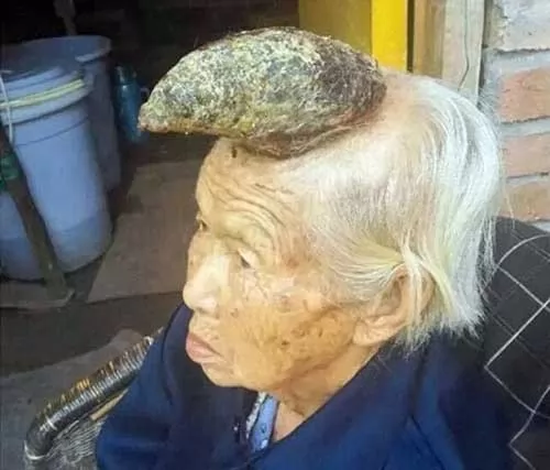 صور - غرائب حول العالم - عجوز صينية نما لها قرن في رأسها طوله 5 بوصة