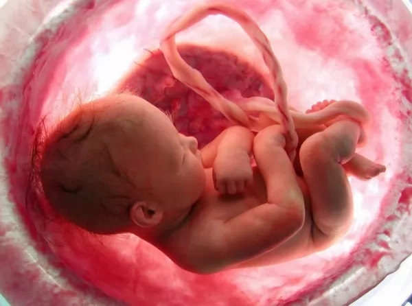 صور - حركة الجنين اثناء مراحل الحمل المختلفة