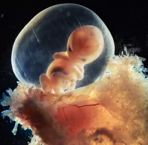  شكل الجنين في الرحم اثناء الحمل 